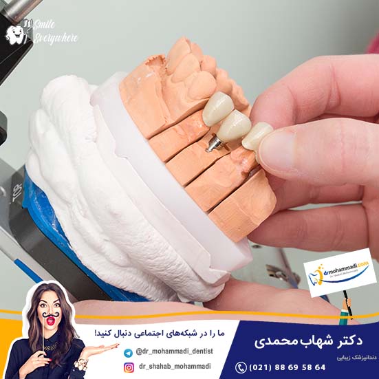  اگر فکی که قرار است ایمپلنت دندان بروی آن قرار بگیرد استخوان کافی نداشته باشد، چه باید کرد؟ - کلینیک دندانپزشکی دکتر شهاب محمدی